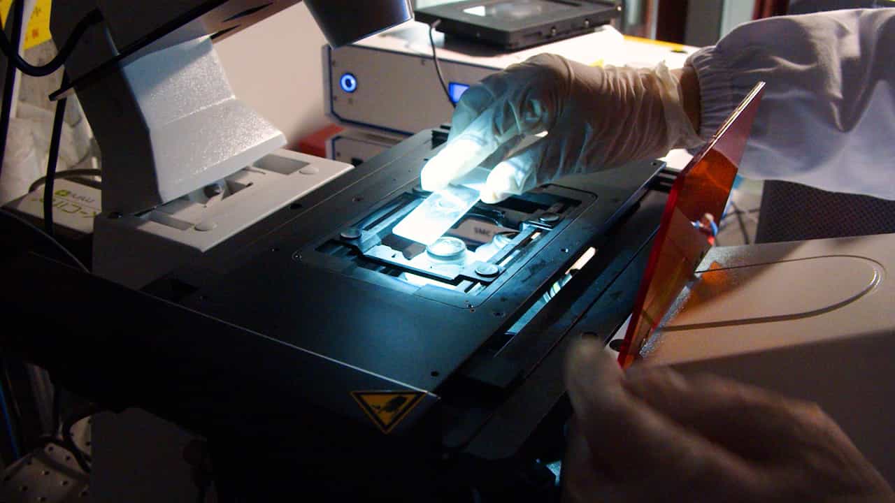 Super-Resolution Imaging and Shared Management: A Protocol for Confocal Microscopy with Multiplex Detection