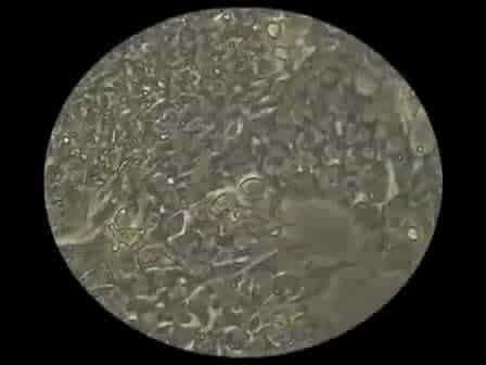 From MEFs to Matrigel I: Passaging hESCs in the Presence of MEFs