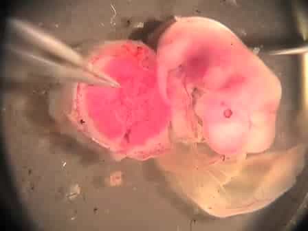 Isolation and Analysis of Hematopoietic Stem Cells from the Placenta