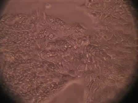 Trypsinizing and Subculturing Mammalian Cells