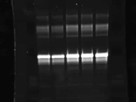 Electrophoretic Separation of Proteins