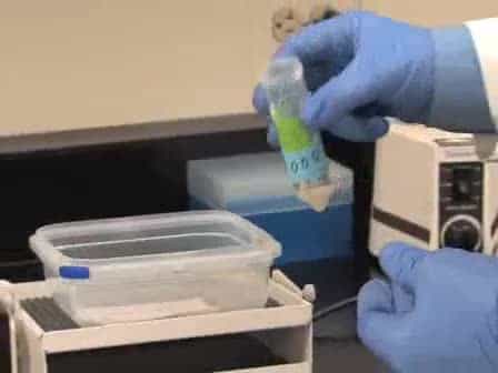 Immunoblot Analysis