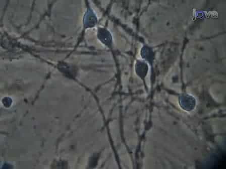 Primary Dissociated Midbrain Dopamine Cell Cultures from Rodent Neonates