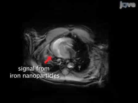 In vitro Labeling of Human Embryonic Stem Cells for Magnetic Resonance Imaging