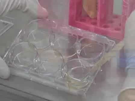 From MEFs to Matrigel 2: Splitting hESCs from MEFs onto Matrigel