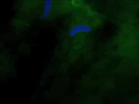 In Vitro Nuclear Assembly Using Fractionated Xenopus Egg Extracts
