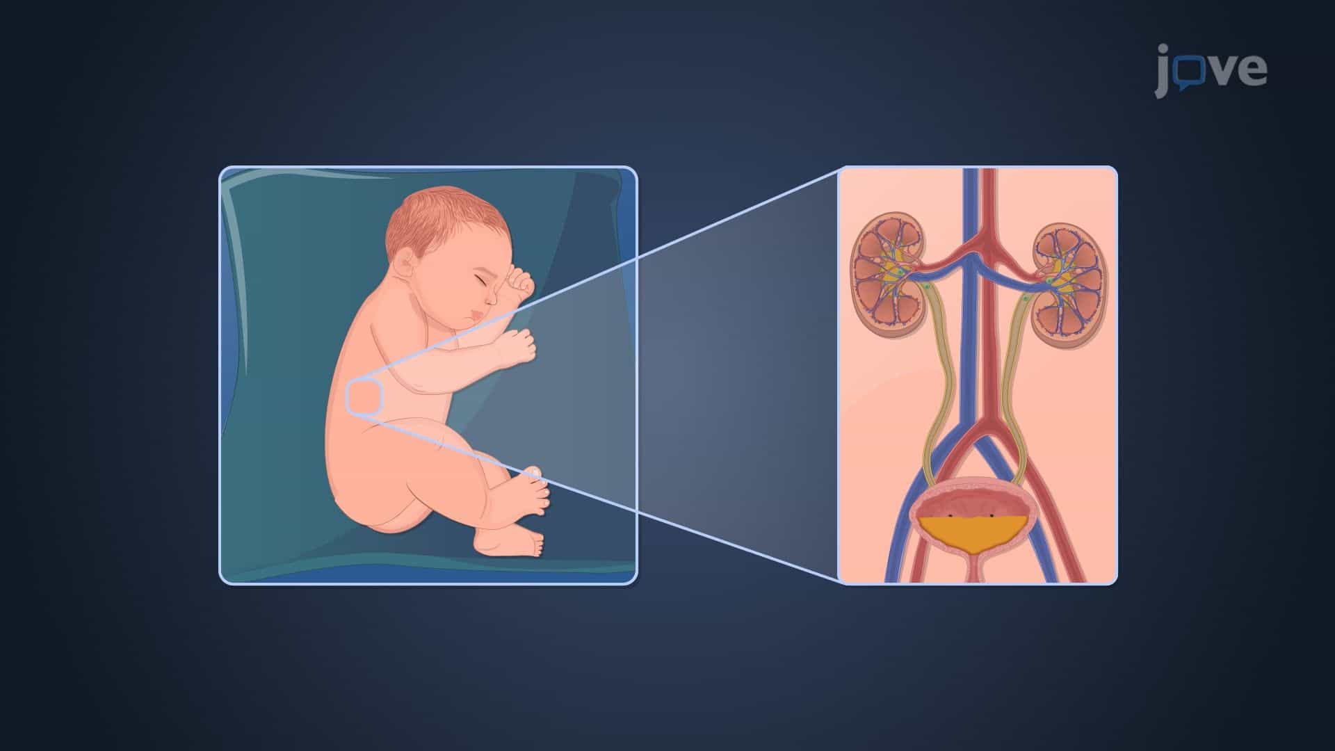 Pharmacokinetics in Pediatric Patients: Drug Excretion