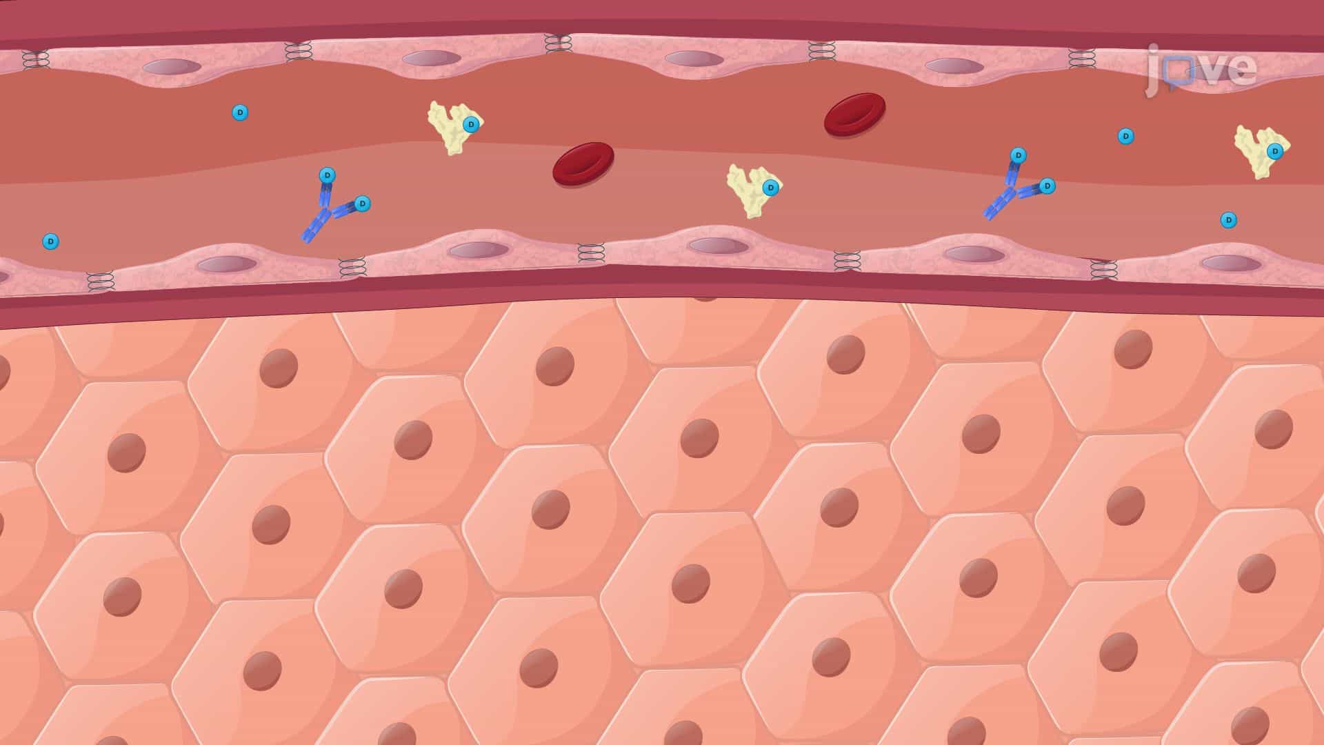Effect of Hepatic Disease on Pharmacokinetics: Drug Dosing and Hepatic Blood Flow