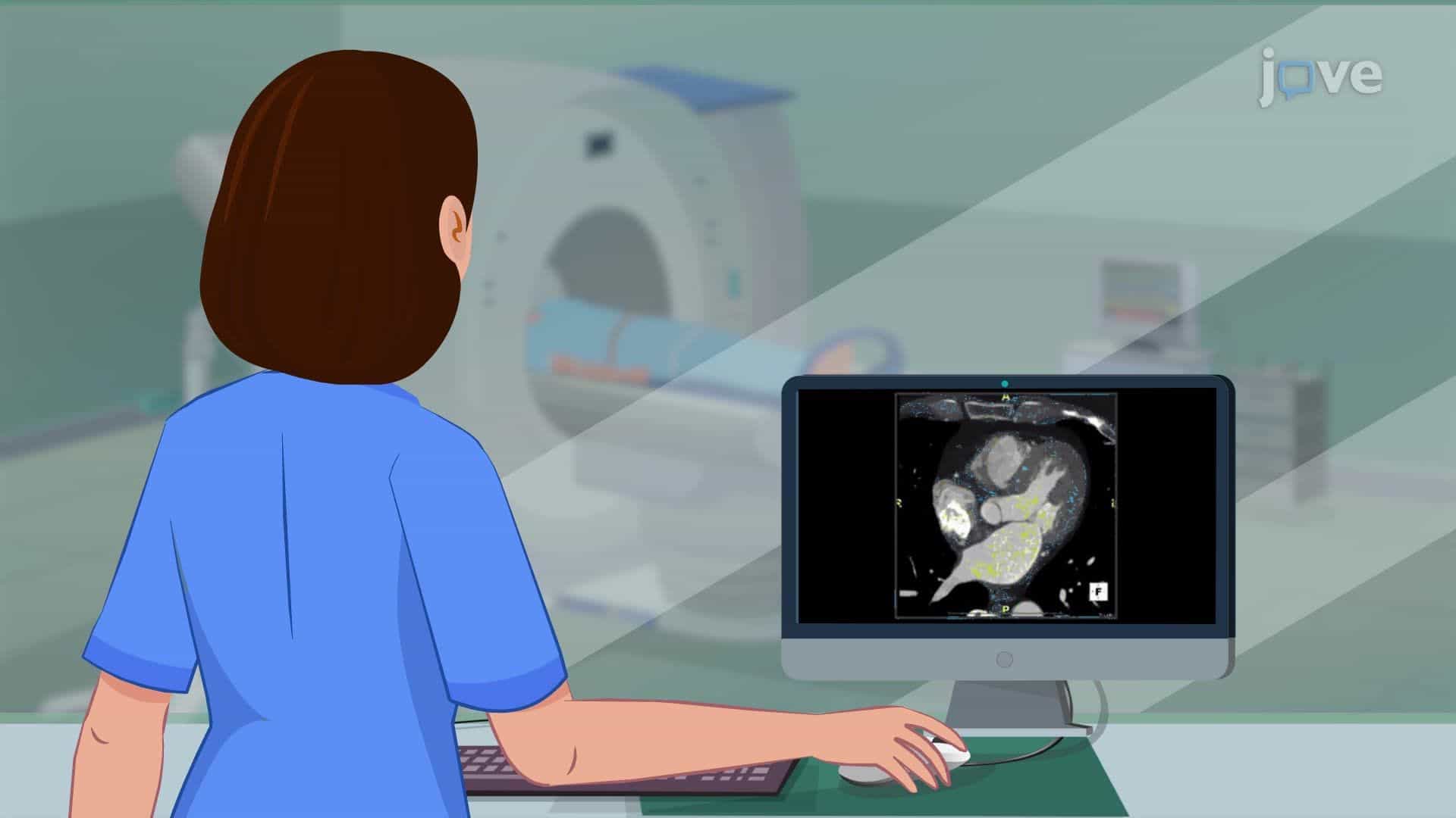 Imaging Studies for Cardiovascular System V: CT
