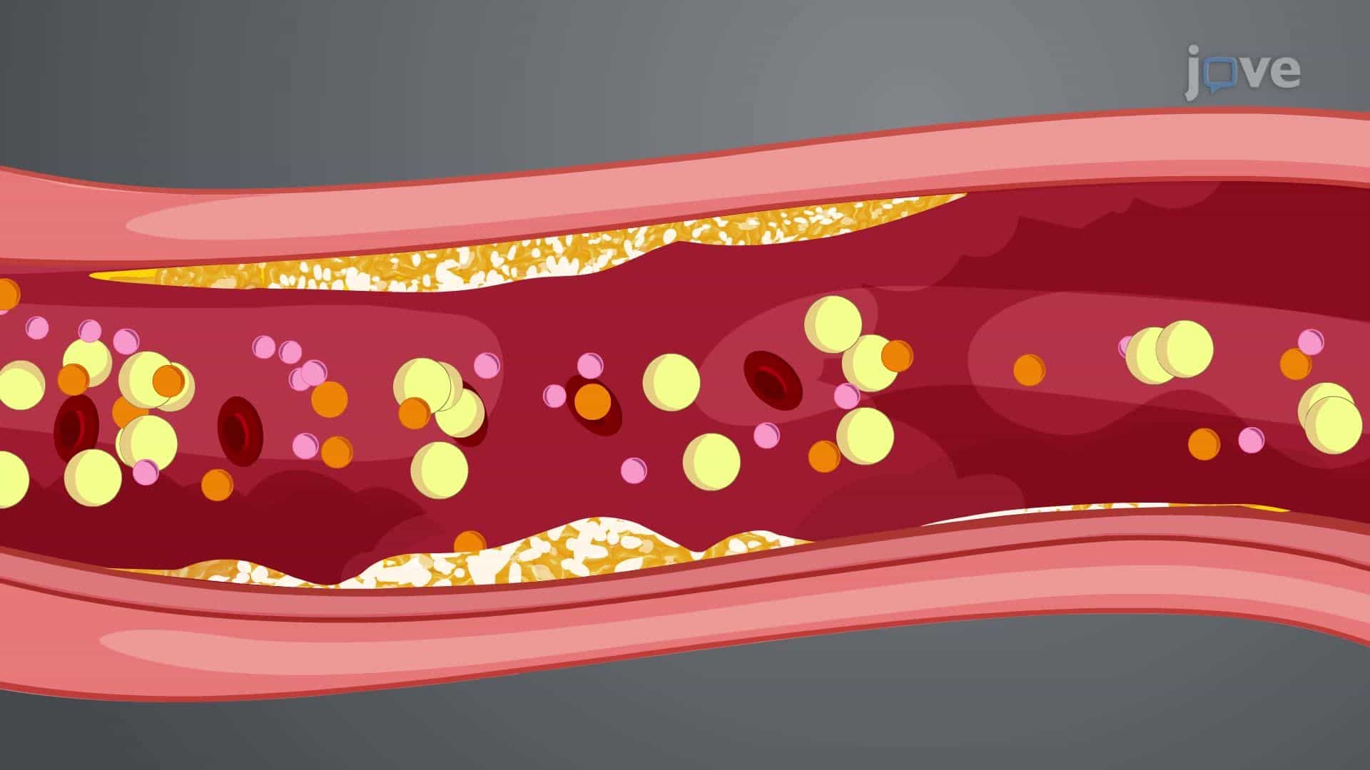 Imaging Studies for Cardiovascular System VI: Calcium -Scoring CT