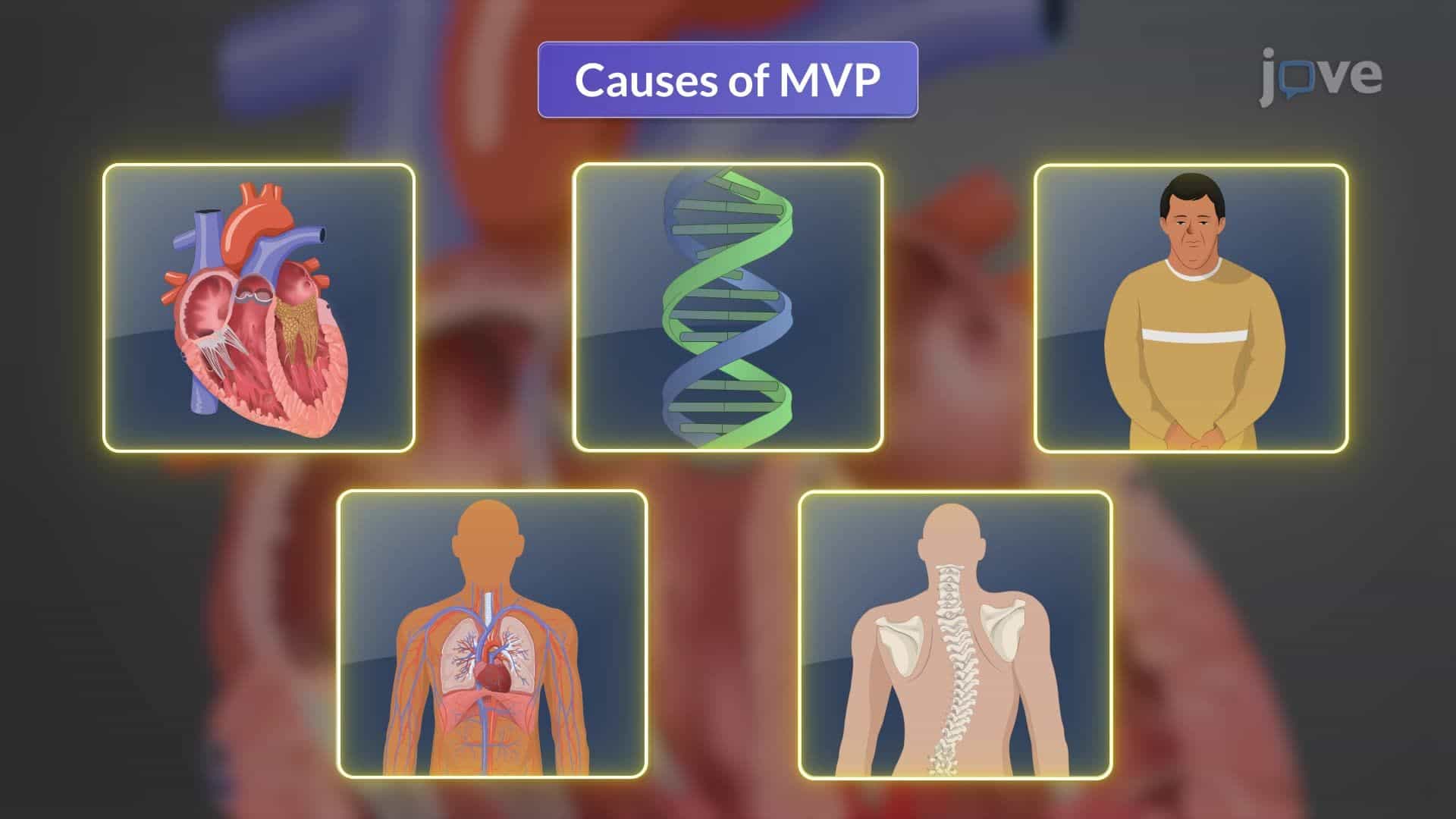 Mitral Valve Prolapse I: Introduction