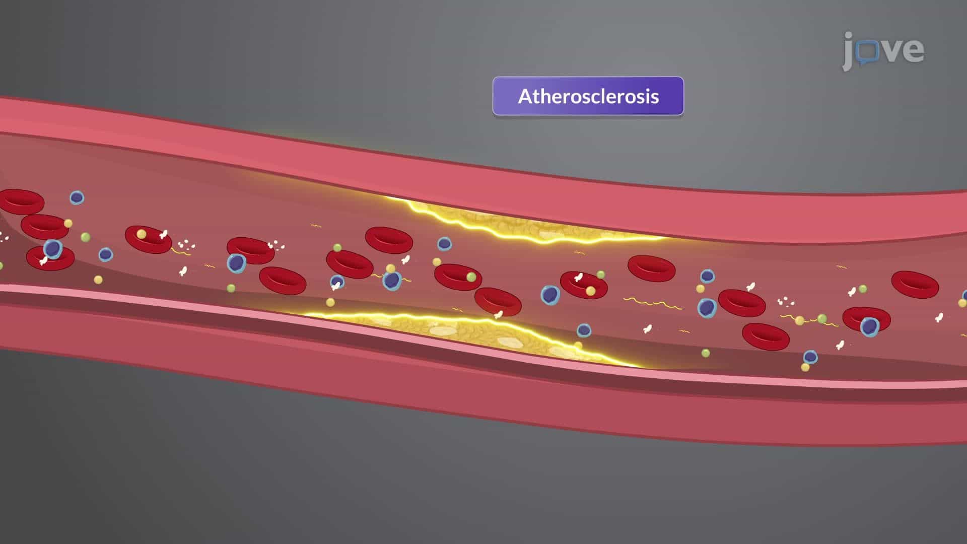 Coronary Artery Disease I: Introduction