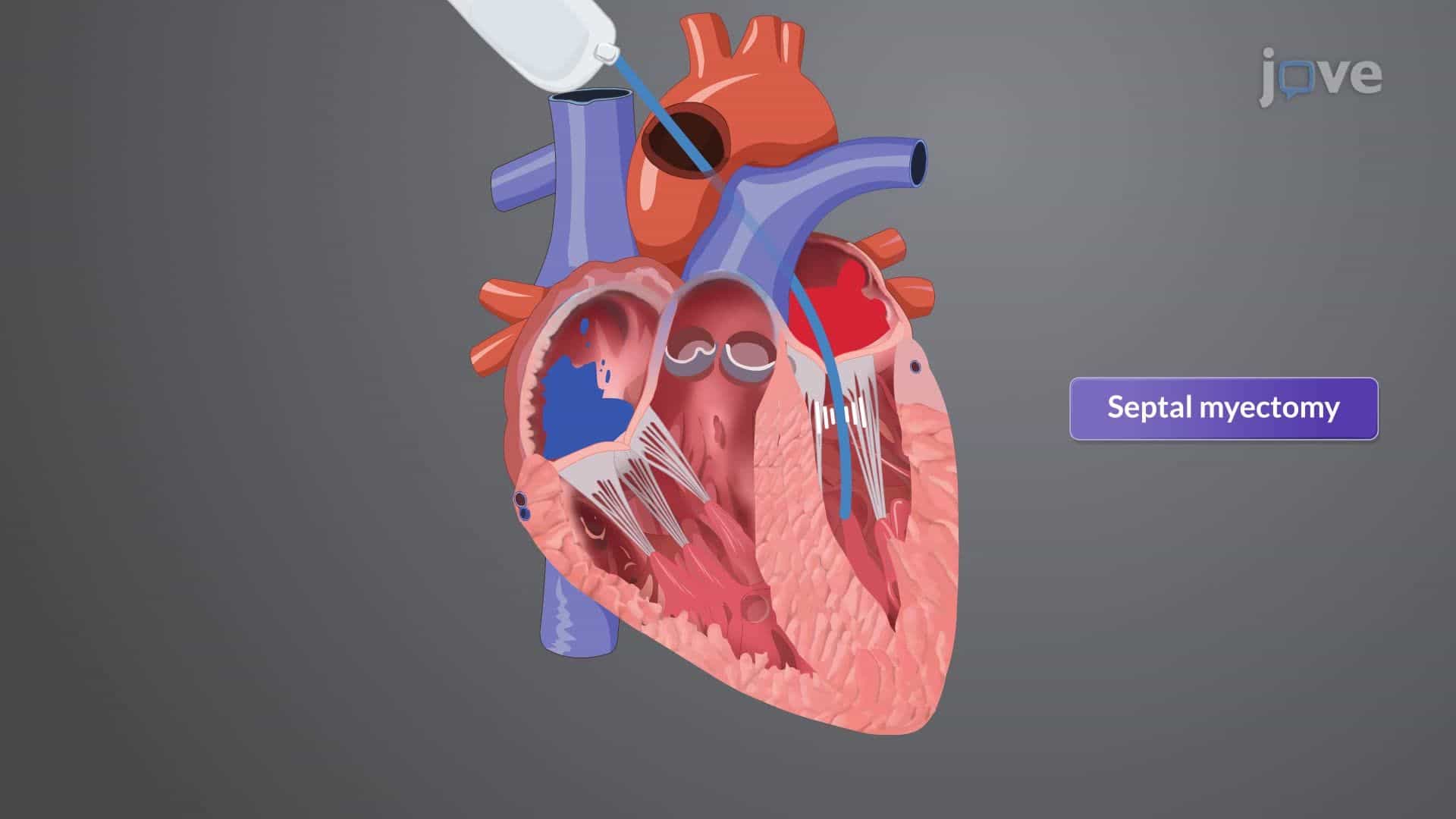 Cardiomyopathy V: Interprofessional Care