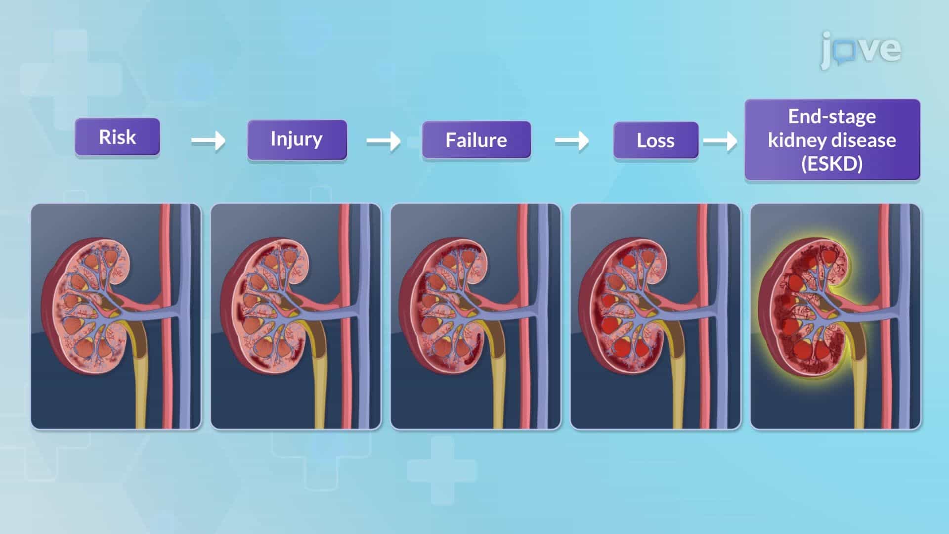 Acute Kidney Injury I: Introduction