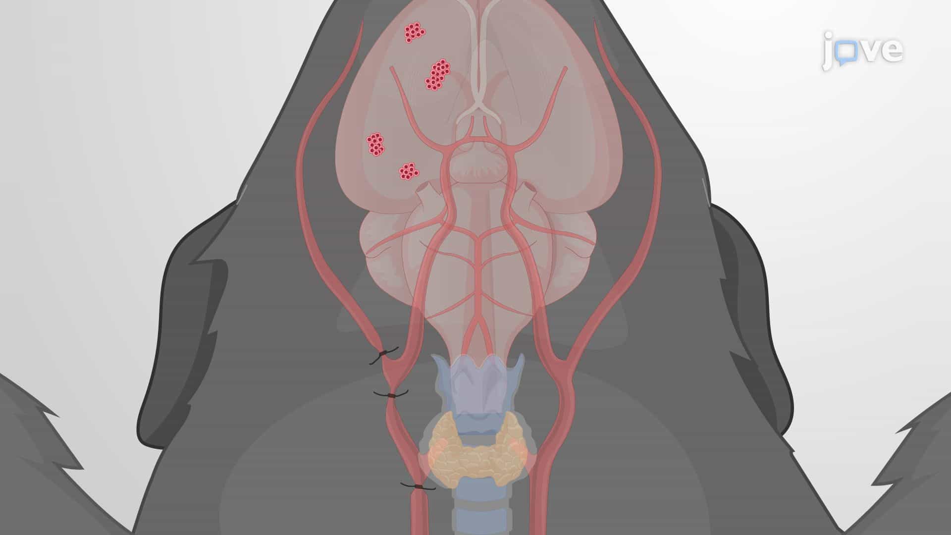 Modeling Brain Tumor Metastasis via Internal Carotid Artery Injection of Cancer Cells