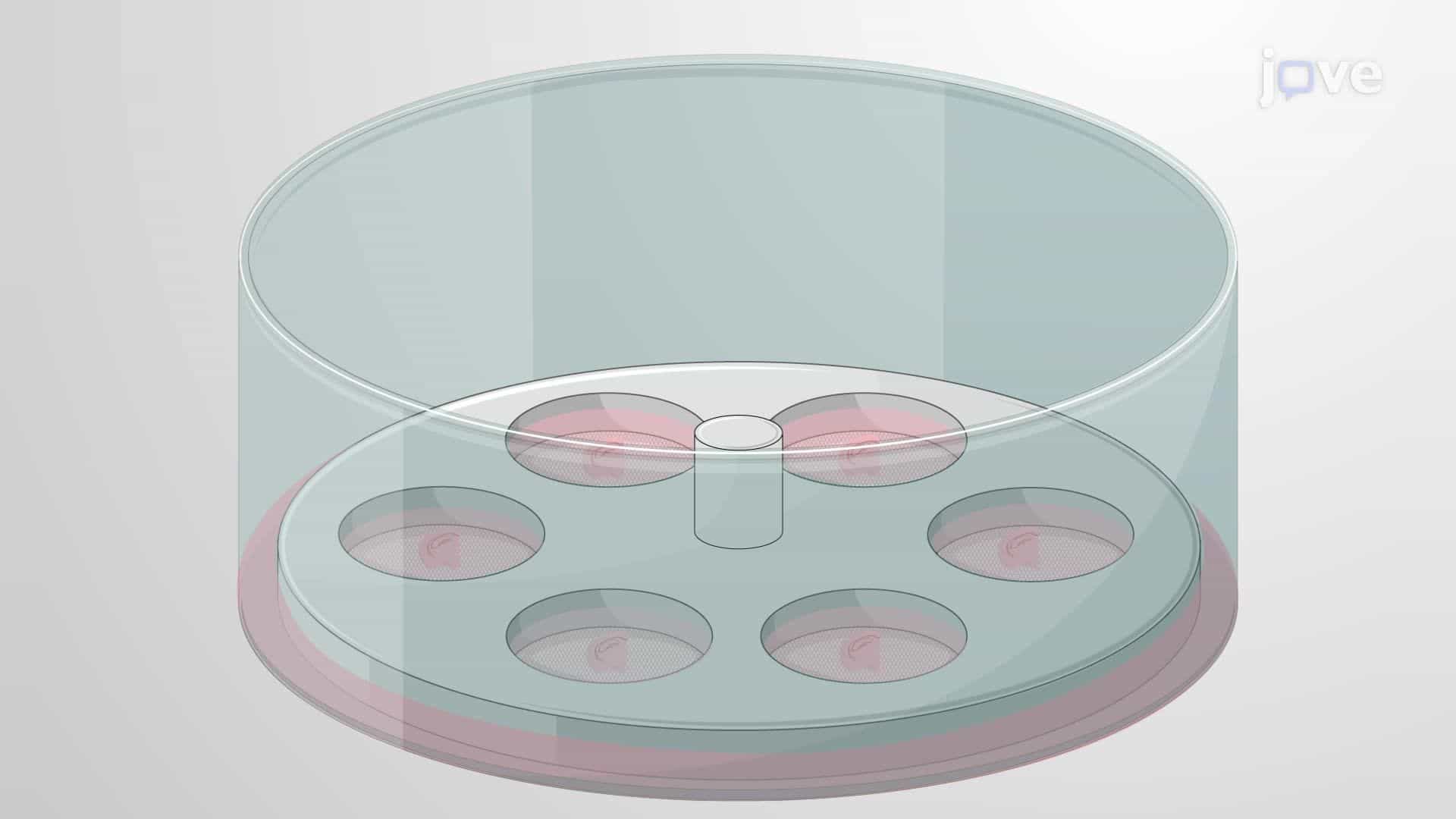 Quantifying Newly Generated Neurons in Rat Brain Tissue Using the Optical Fractionator Technique