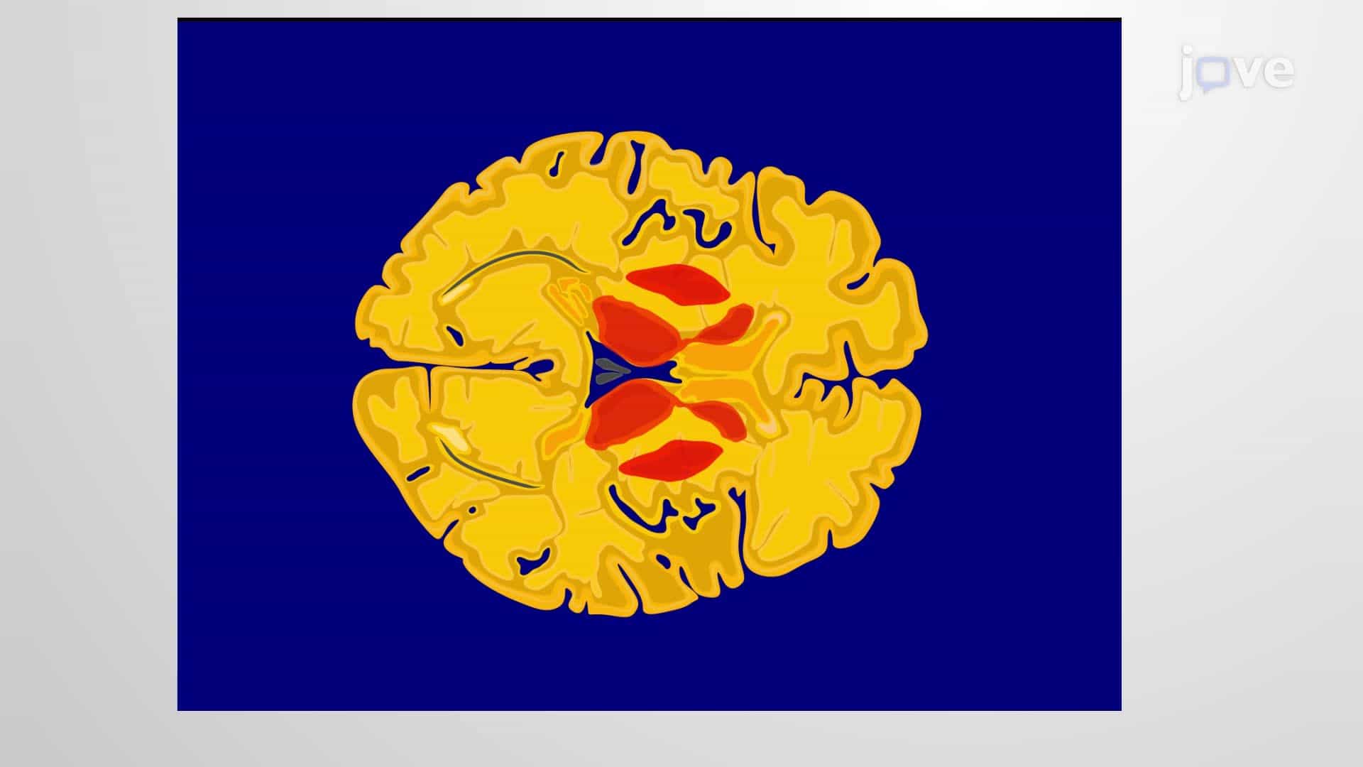 Developing a Cerebral Blood Flow Atlas for Blood Flow Mapping