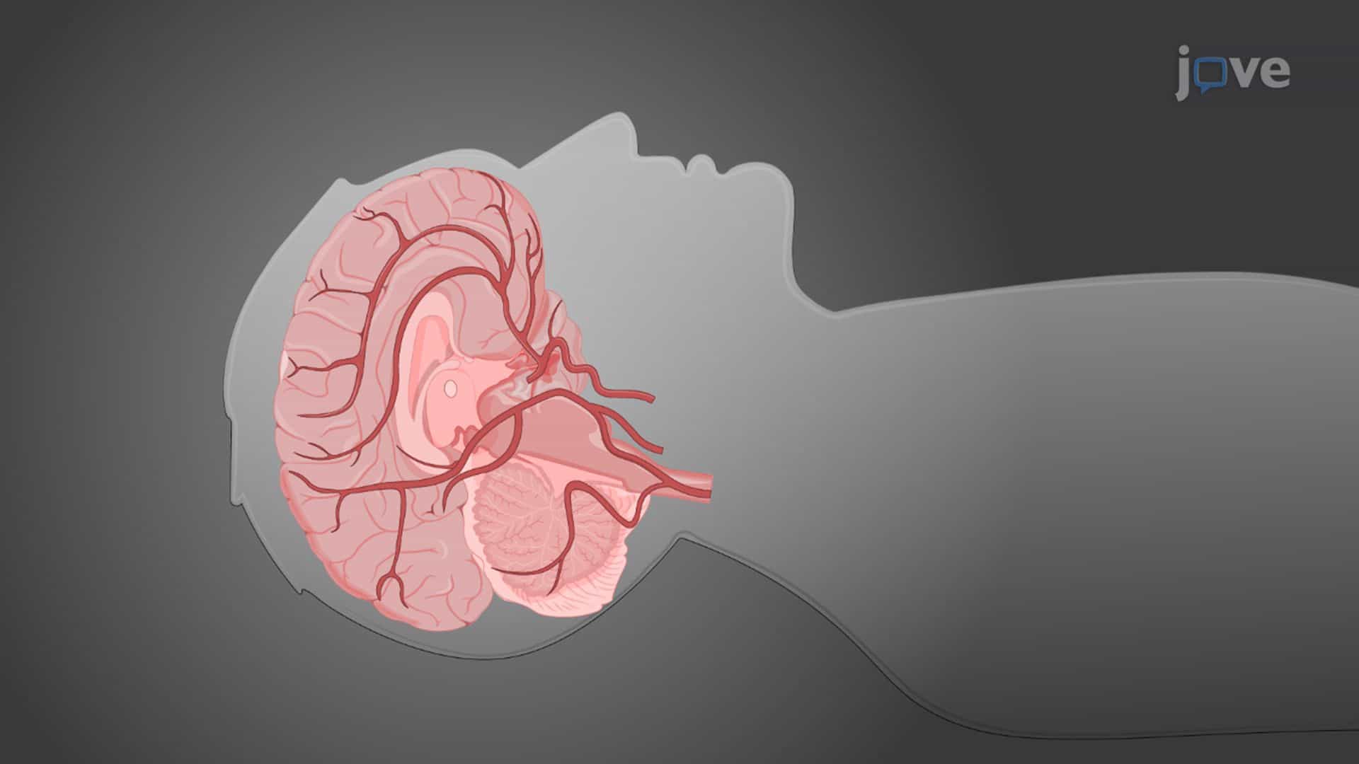 Measuring Cerebral Blood Volume in the Auditory Cortex Using Vascular Space Occupancy