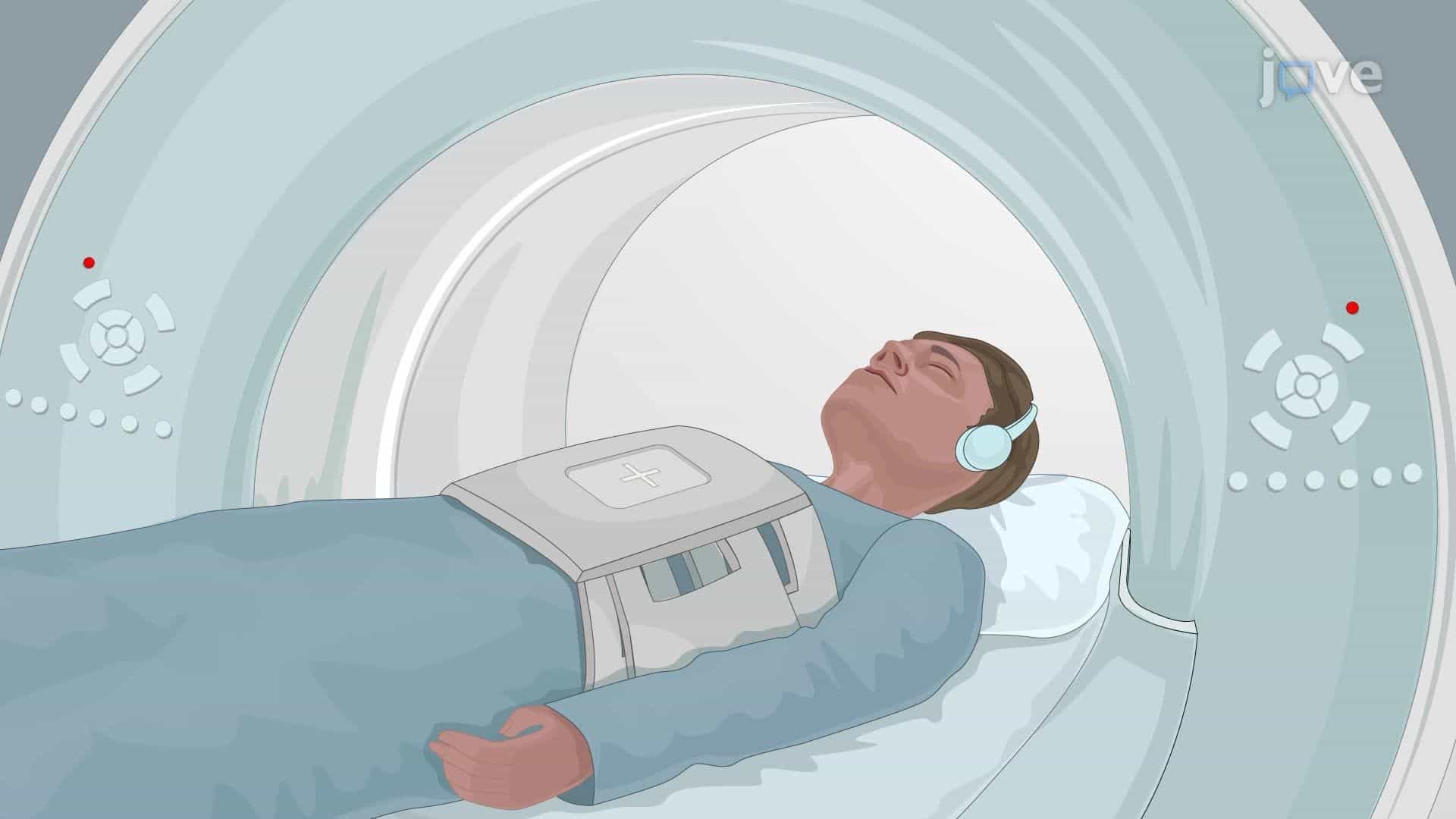 Assessing Spinal Cord Compression Using Diffusion Tensor Imaging