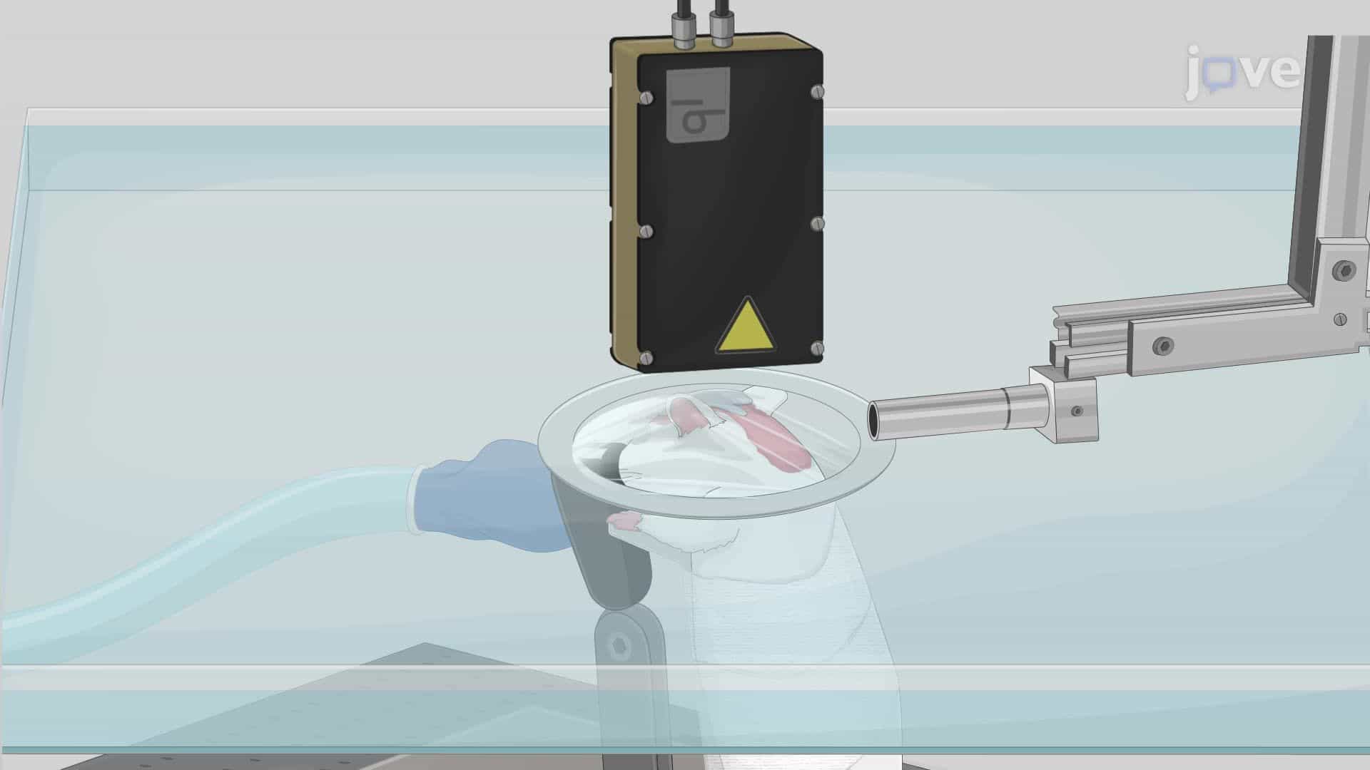 In Vivo Imaging of a Rat Brain Using Photoacoustic Tomography