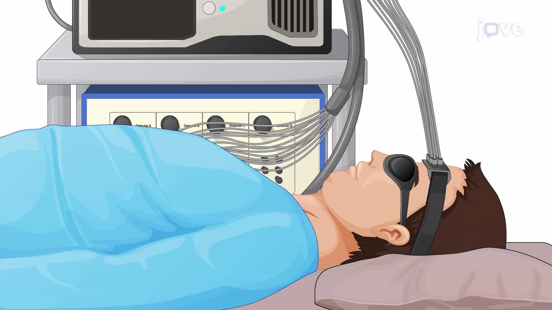 Diffuse Correlation Spectroscopy to Measure Cerebral Blood Flow in a Human Subject