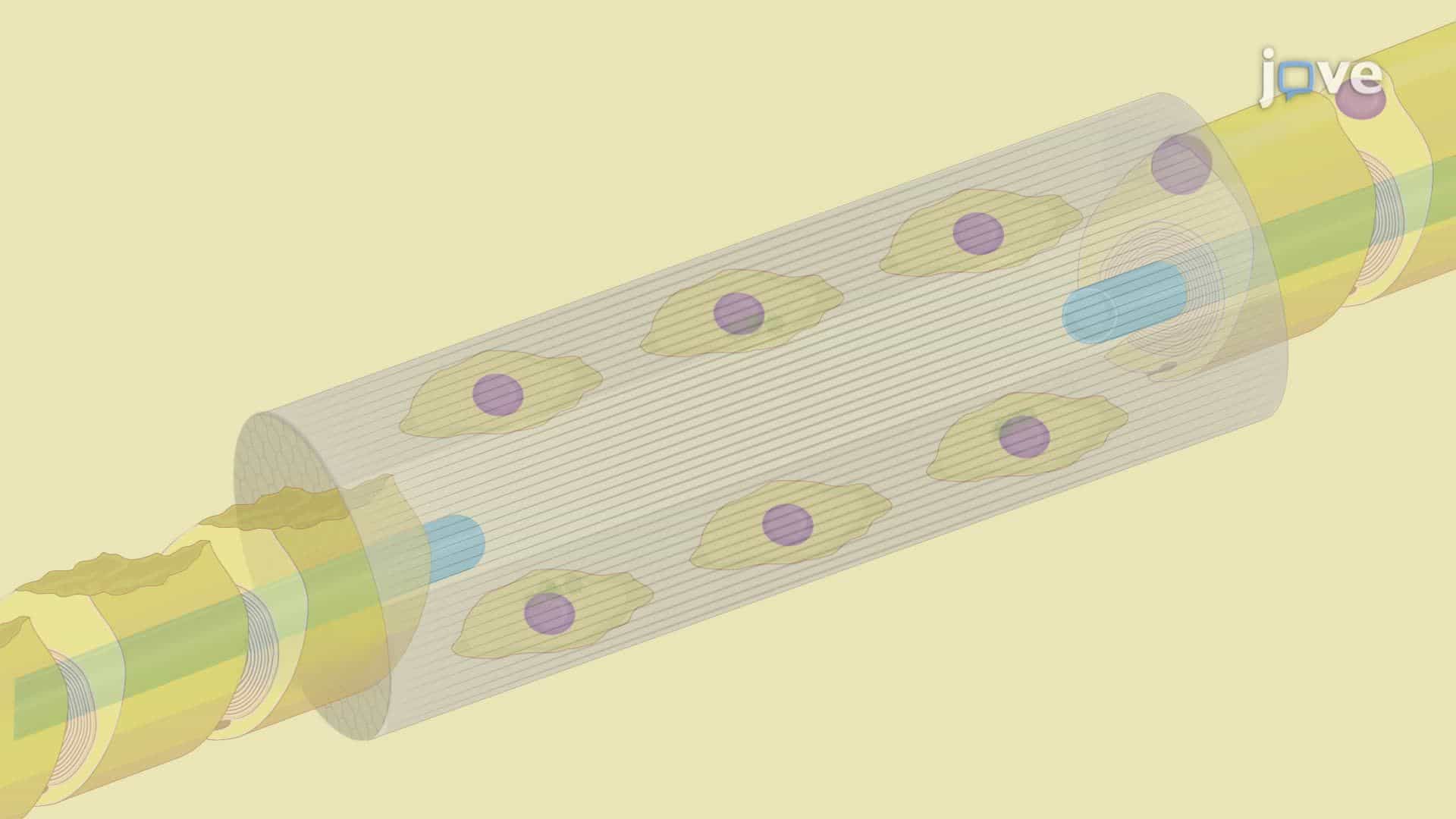 Nerve Repair Using a Bionic Conductive Scaffold Combined with Electrical Stimulation