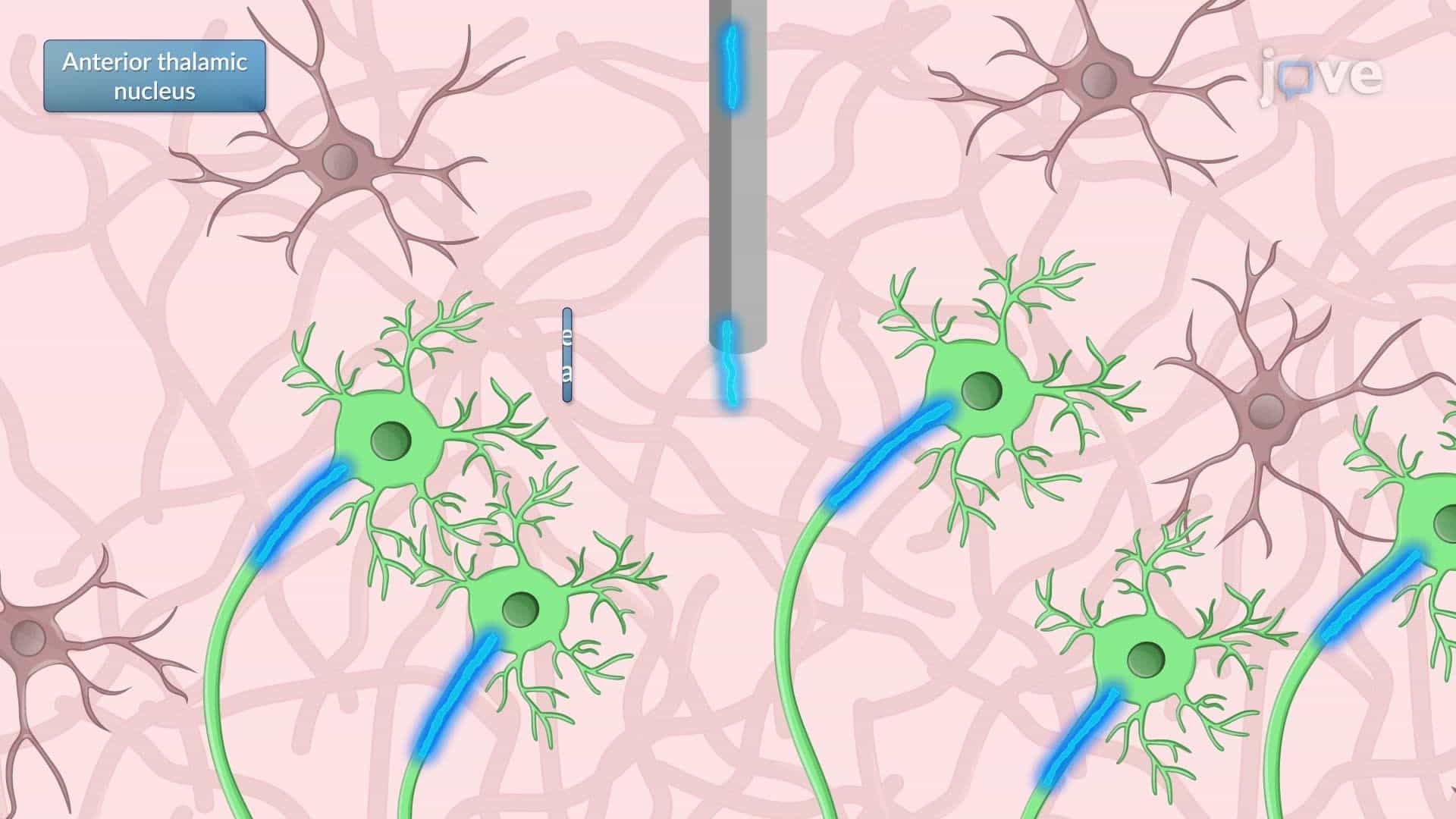 Effects of Deep Brain Stimulation on Hippocampal Neuronal Activity in a Rat Model