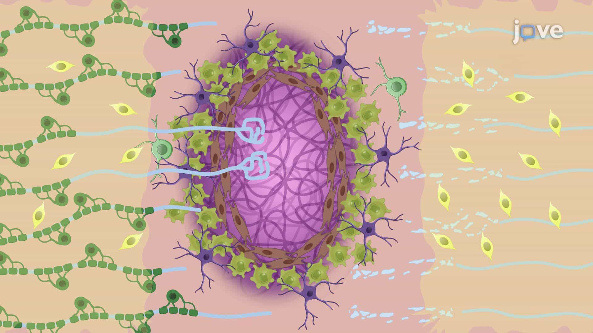 Injecting Self-Assembling Peptides and Neural Precursor Cells for Spinal Cord Repair in a Rat Model