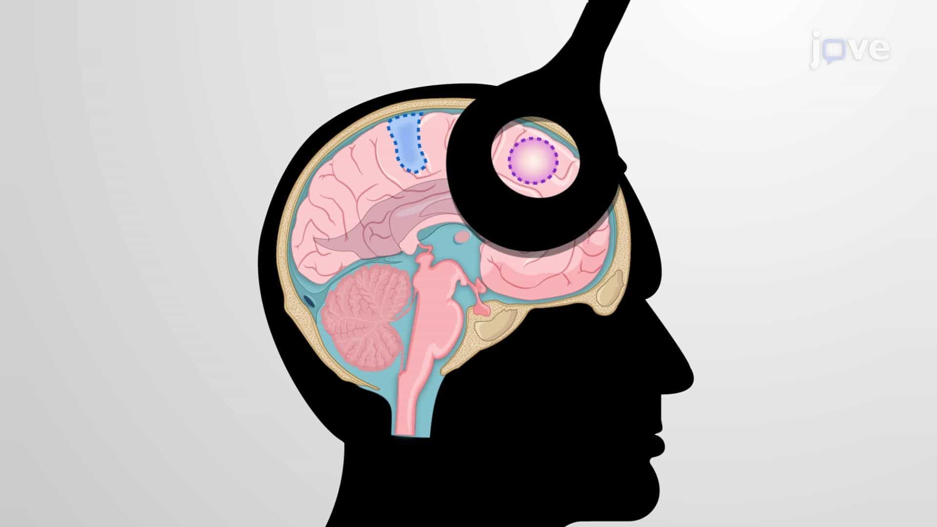 Continuous Theta Burst Stimulation to Reduce Responses to Ideological Threats