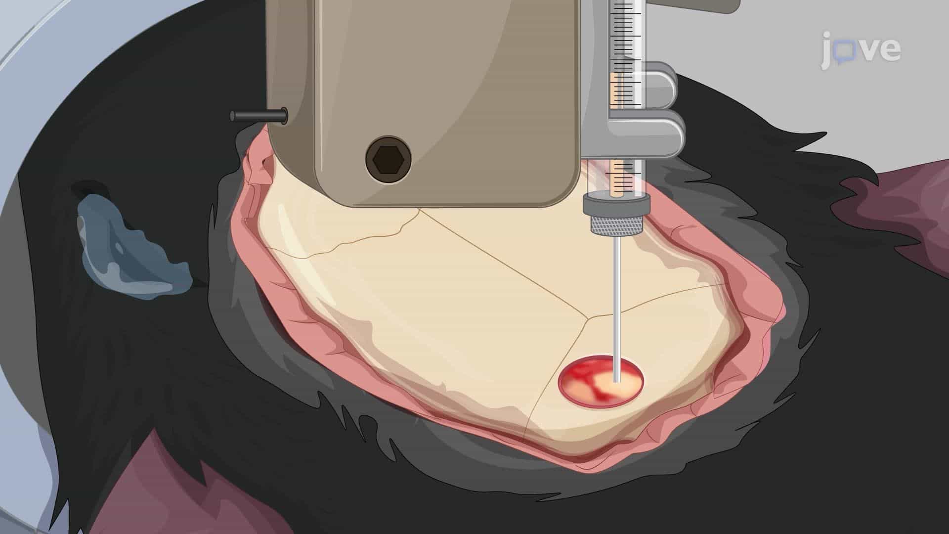 Virus-Mediated Gene Transfer Into the Mouse Dorsal Cochlear Nucleus for Light-Induced Auditory Stimulation