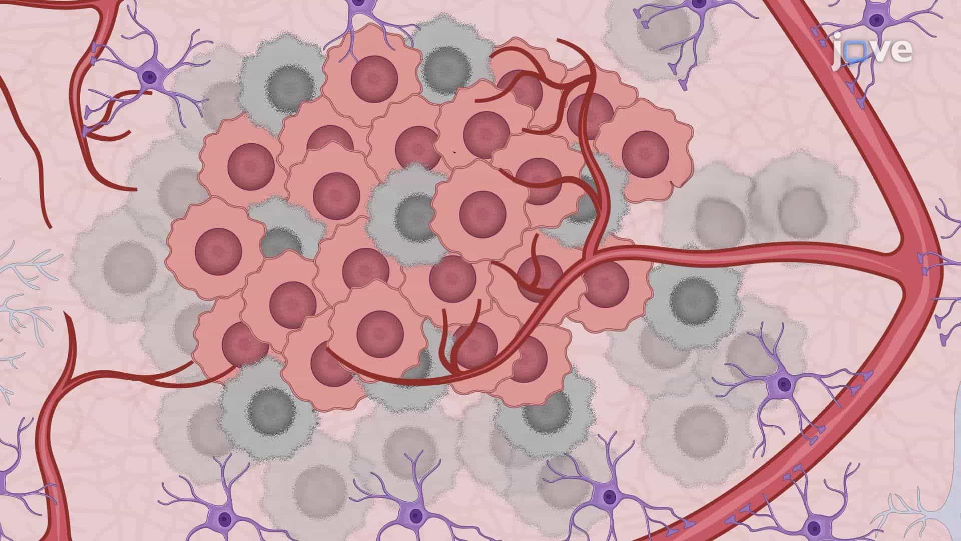 Treatment of Brain Tumors in a Mouse Model Using Sonodynamic Therapy