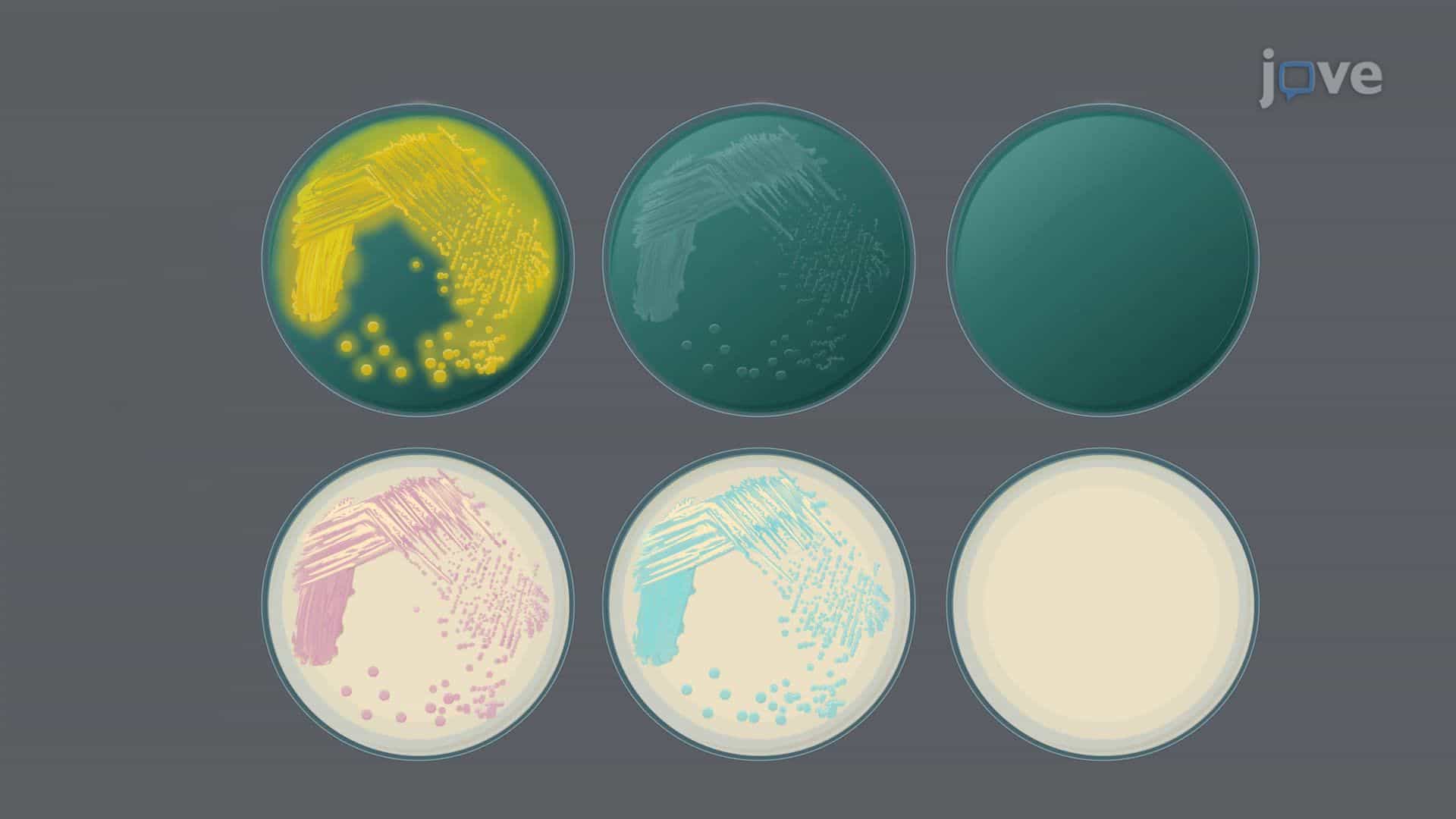 A New Chromogenic Medium for Rapid Detection of Vibrio Species