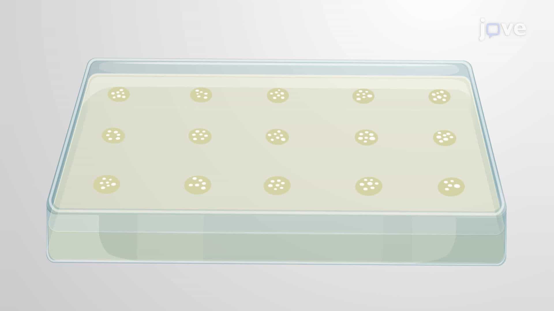 Quantification of Colony-Forming Units of Gut-Associated Bacteria in Drosophila Flies
