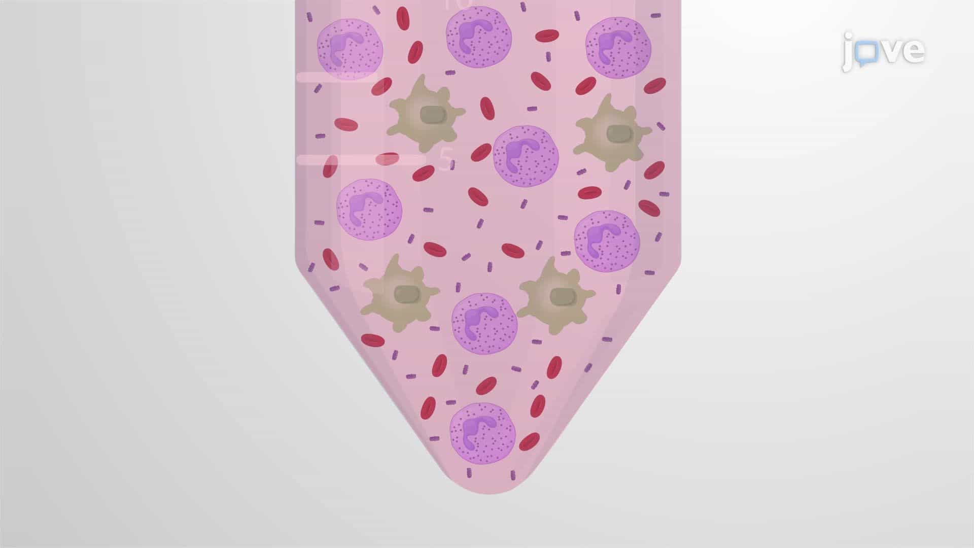 Bronchoalveolar Lavage Fluid Collection from a Mouse Model Infected with Non-typeable Haemophilus influenzae