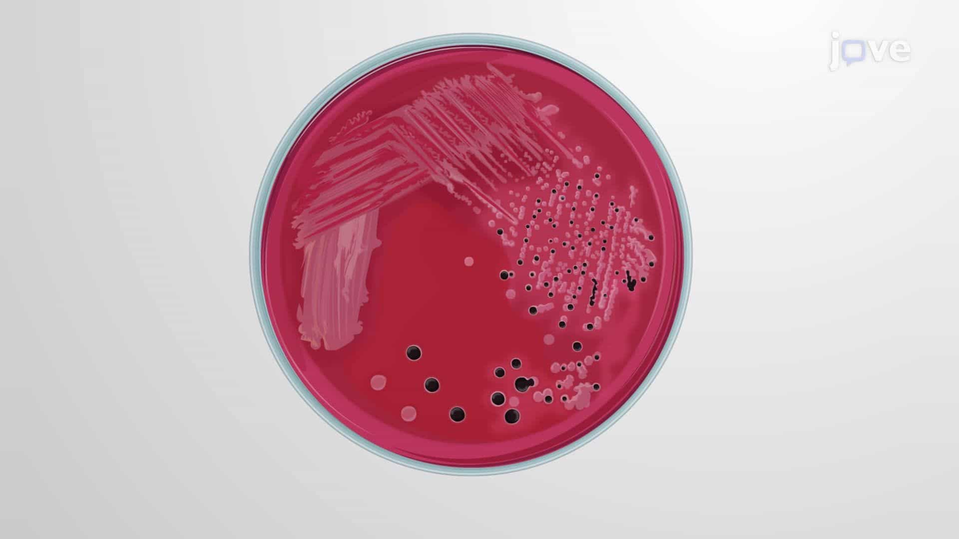 Selective Enrichment and Identification of Salmonella spp. Using Xylose Lysine Deoxycholate and Chromogenic Agar