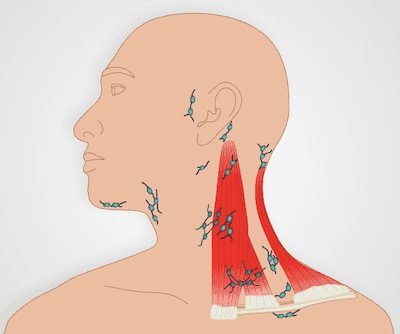 Lymph Nodes: Head &amp; Neck, Axillae, Upper &amp; Lower Extremities