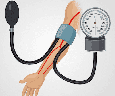 Blood Pressure Measurement Using a Sphygmomanometer