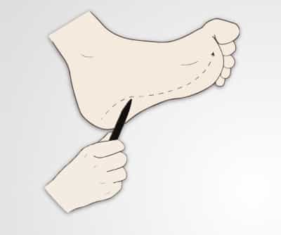 Motor Exam II: Reflex, Coordination, Gait and Station Testing