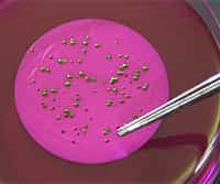 Isolation and Identification of Fecal Bacteria from Water