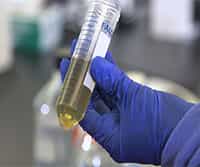 Community DNA Extraction from Bacterial Colonies
