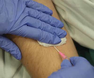 Discontinuing Intravenous Fluids and Peripheral Intravenous Line