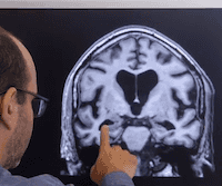 Testing Short- and Long-term Memories in Patients with Brain Injuries