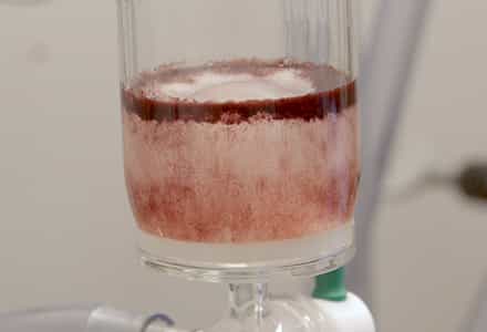 Solid Phase Synthesis: Principles, Peptide Synthesis