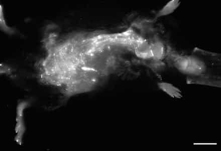 Near-infrared Fluorescence Imaging of Abdominal Aortic Aneurysms