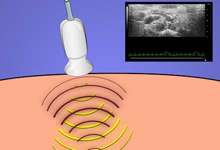High-frequency Ultrasound Imaging and Image Acquisition