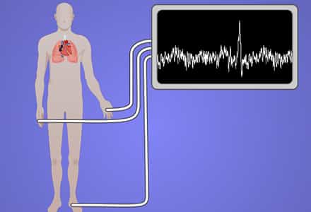 Acquisition and Analysis of an ECG electrocardiography Signal