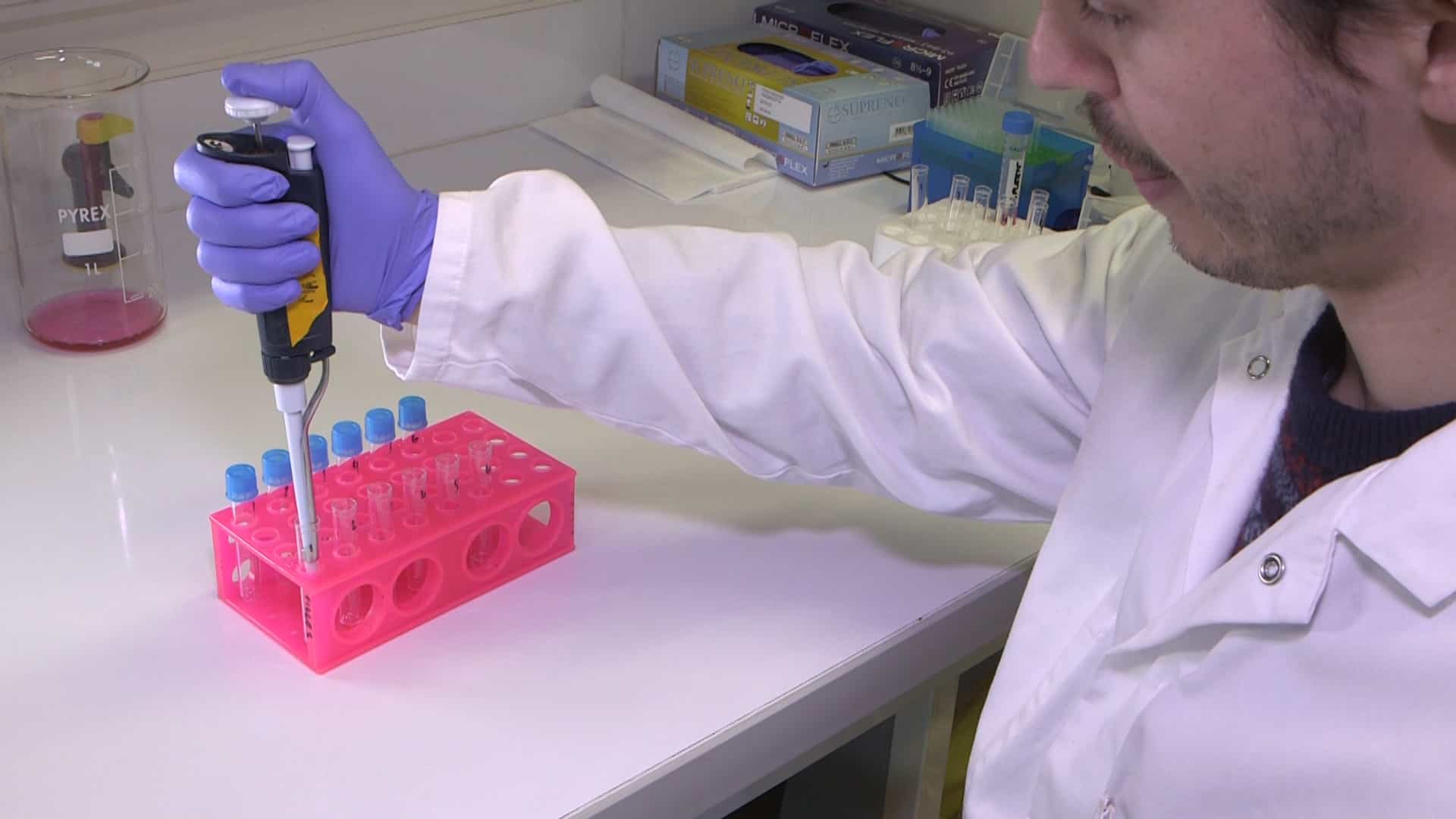 Flow Cytometry and FACS: Isolation of Splenic B Lymphocytes