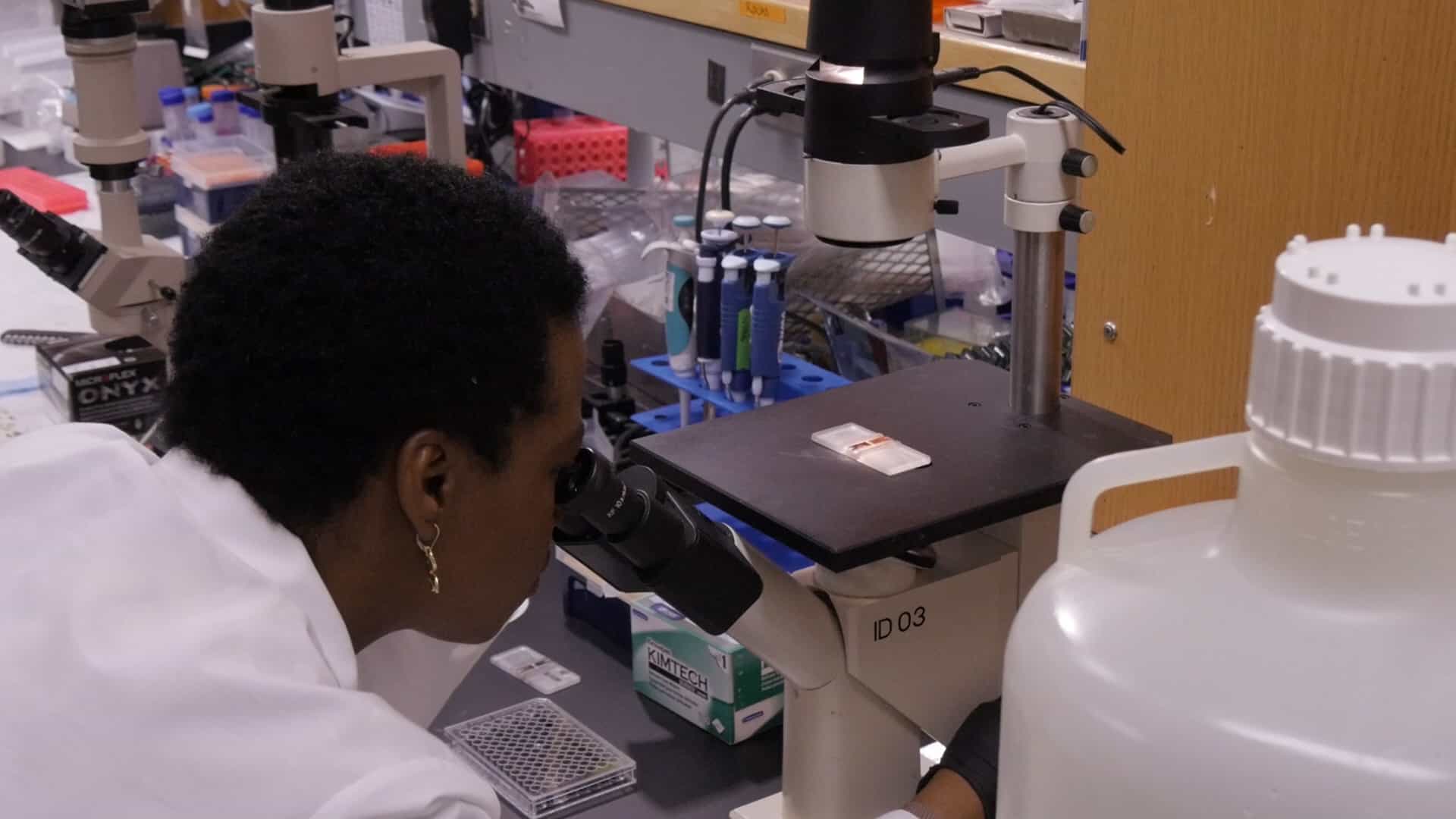 ELISPOT Assay: Detection of IFN-&amp;#947; Secreting Splenocytes