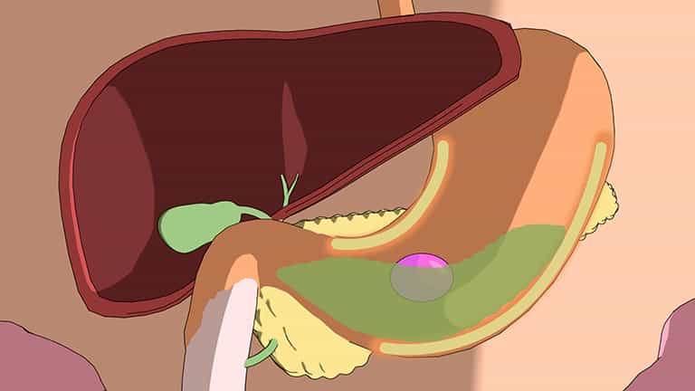 Hormonal Regulation of Digestion