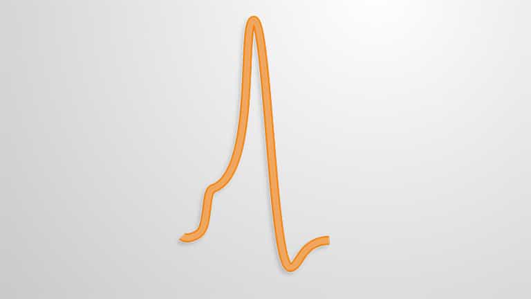 Action Potential and Saltatory Conduction